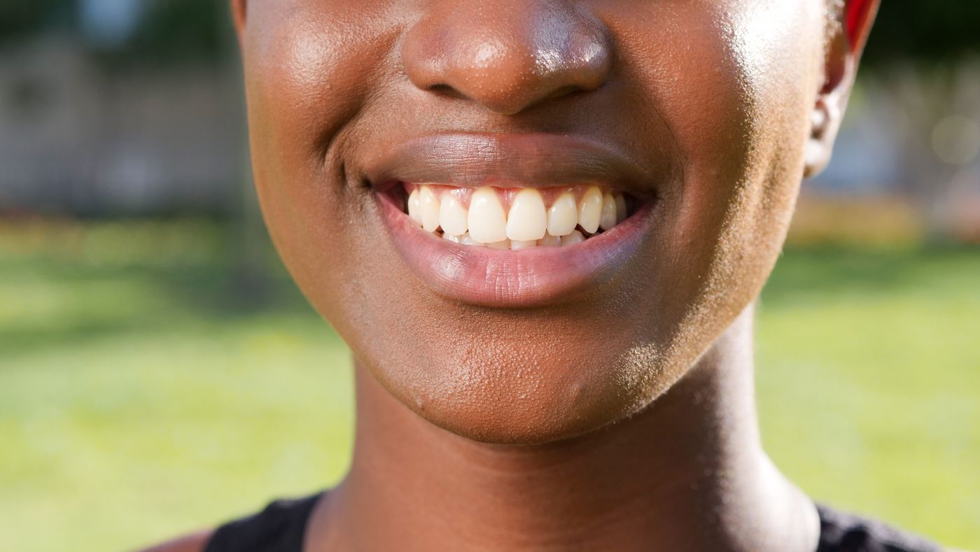 Cosmetic dentistry